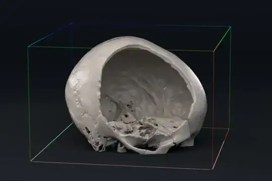 CT scan rendered with cycles