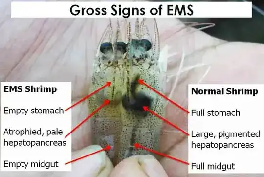 signs of EMS