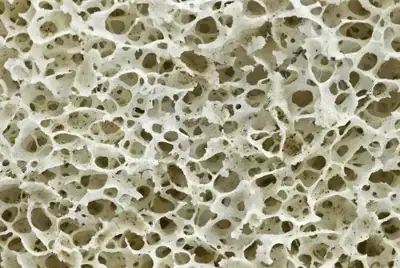 cancellous bone(hip)