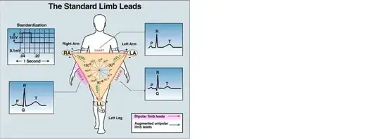 ecg lead connection