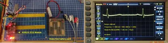 AD8232 Setup and results