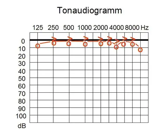 Audiogram (wikipedia)