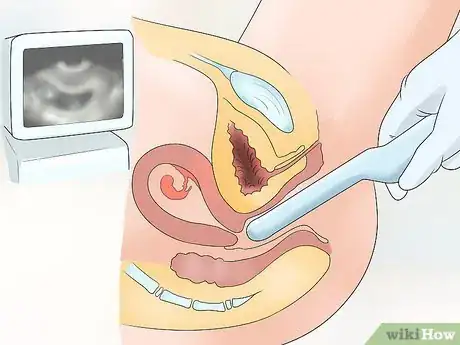 Image titled Calculate Your Due Date Step 11