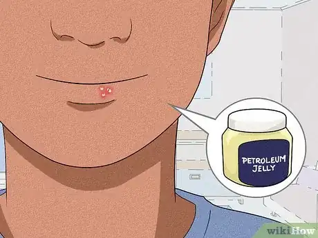 Image titled Heal Cold Sore Crust Step 2