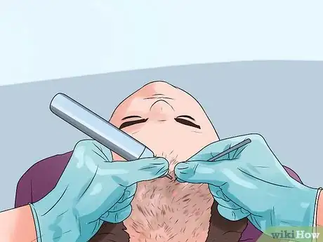 Image titled Stop Rapid Hair Loss Step 17