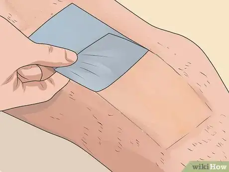 Image titled Use Hair Removing Wax Step 6