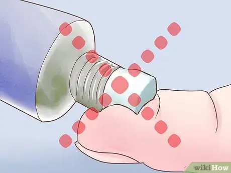 Image titled Clean Your Nose Piercing Step 8