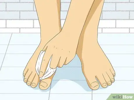 Image titled Clean Stinky Winter Boots Step 5