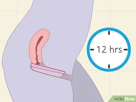 Image titled Use an Instead Softcup Step 6