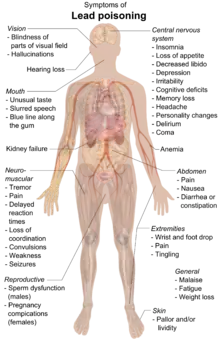 A chart of a human body with arrows pointing pieces of text to different parts of the body
