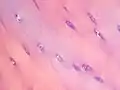 Chondrocytes in hyaline cartilage