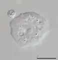 Acanthamoeba sp. (Discosea)